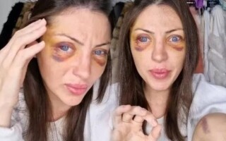 Brazilian 'human Barbie' influencer passes away